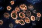 　新型コロナウイルスの電子顕微鏡写真（米国立アレルギー感染症研究所提供）