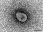 　新型コロナウイルス・オミクロン株の電子顕微鏡写真（国立感染症研究所提供）