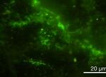 　２０億年前の地層から見つかった微生物。緑色に着色されている（東京大提供）