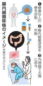 　腸内細菌移植のイメージ