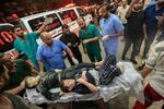 　イスラエル軍の攻撃で負傷し、病院に搬送される負傷者ら＝２９日、パレスチナ自治区ガザ南部ハンユニス（ゲッティ＝共同）