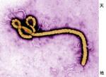 　エボラウイルスの電子顕微鏡写真（米疾病対策センター提供）