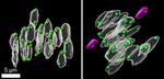 　分裂開始から５時間後の染色体の模式図。老化した卵母細胞（右）では分離が起きているが、若い卵母細胞（左）では起きていない（理研提供）