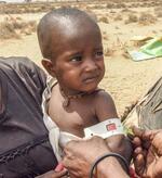 　二の腕の細さから重度の栄養不良と判定されたナオミ・サンチルちゃん＝２０２２年２月、ケニア北部マルサビット郡（中野智明氏撮影・共同）